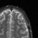 Sandra’s brain